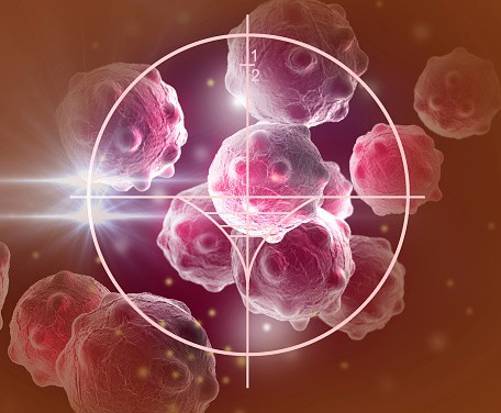 Role Of Cilia In Cancer Development