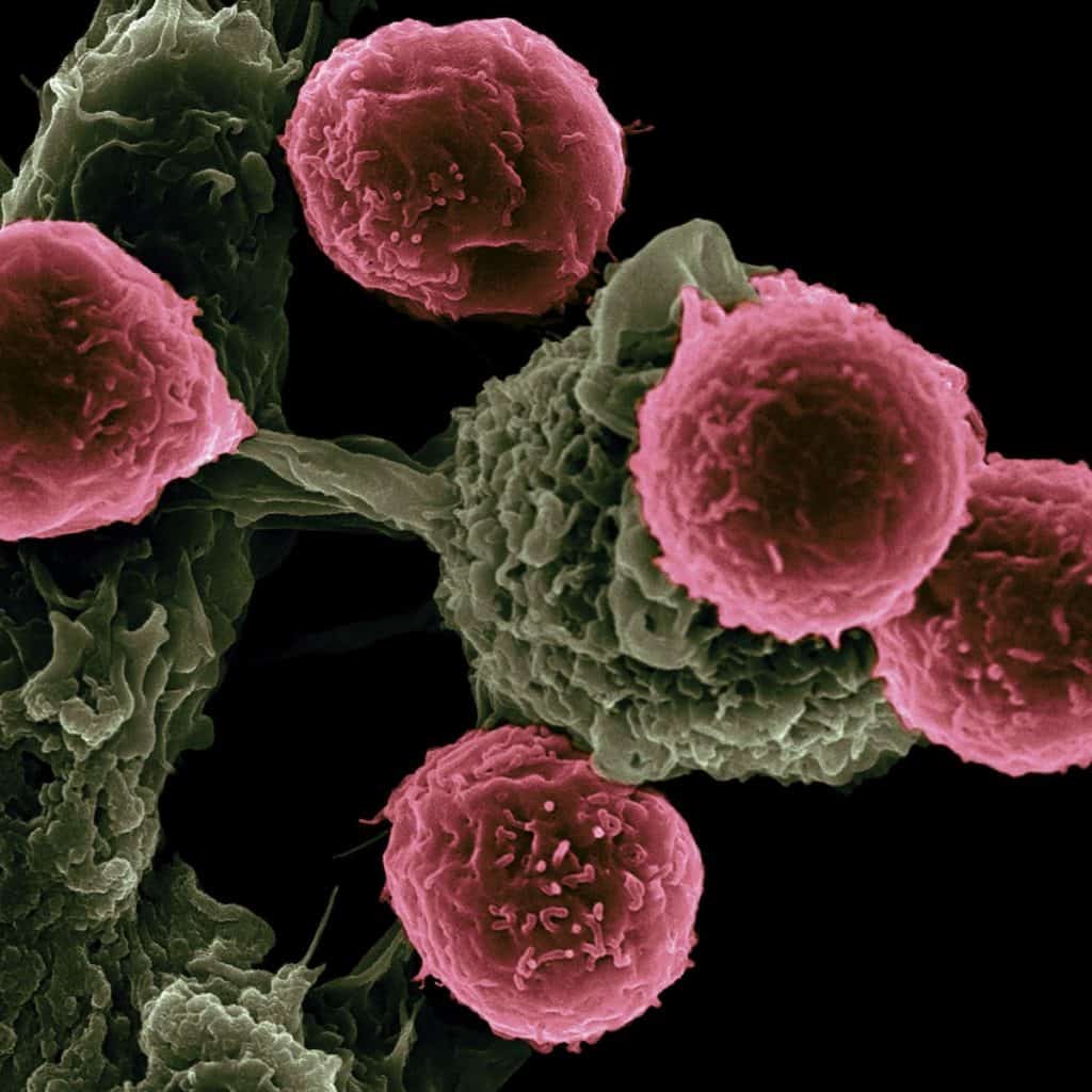 Mystery Of Cilia And Cancer: 